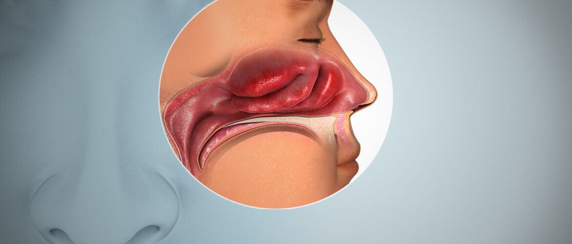 VNS for Long COVID: Restoring Taste and Smell Post-Infection